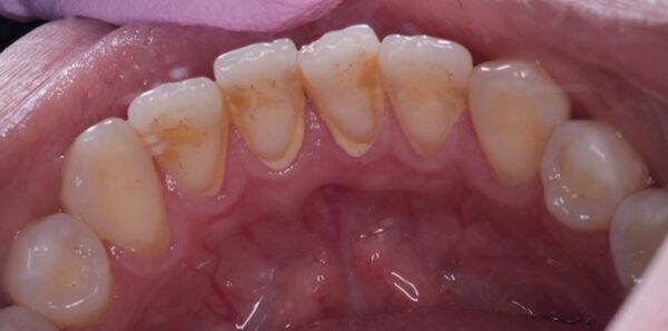 Before image