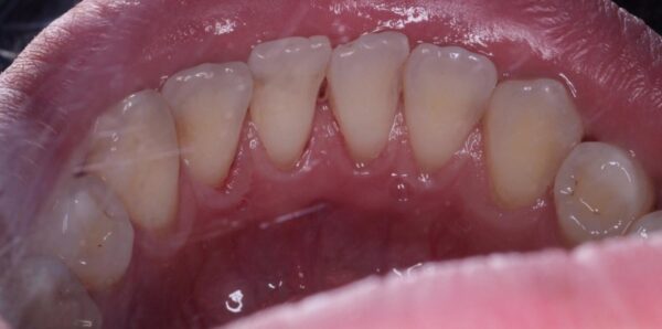 After image