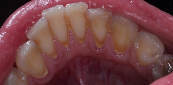 Before image